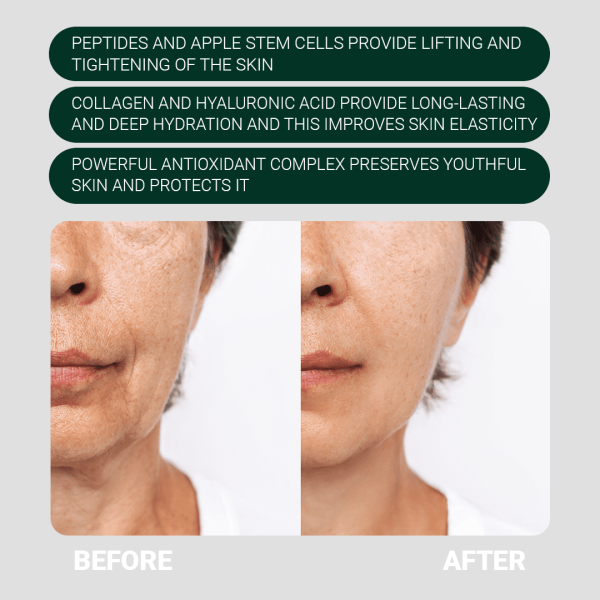 Face Cream With Apple Stem Cells | Amazing Anti-Aging and Nourishing Effect